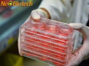 Soluções NeoBiotech para FBS: Fatores que influenciam o desempenho