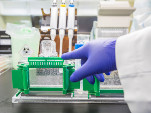 Protocolo Western Blot