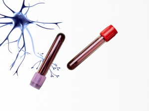 Amostras derivadas de seres humanos para investigações neurológicas