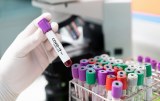 SARS-CoV-2 - Testes serológicos para investigação e desenvolvimento